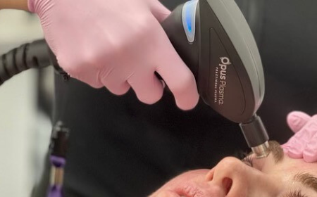 Smooth, Firm, and Youthful: Laser Skin Tightening in Las Vegas at Estevez Aesthetics MedSpa