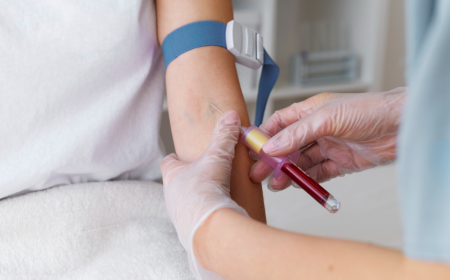 Advancements in Hemophilia B: DelveInsight’s In-Depth Analysis