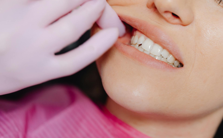 All About Dental Crowns and Bridges: Restore Your Smile with Confidence