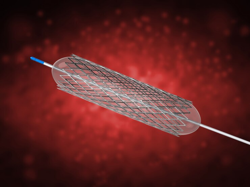 The Growing Global Airway Stent Market: Trends, Drivers, and Future Outlook