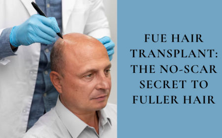 FUE Hair Transplant: The No-Scar Secret to Fuller Hair
