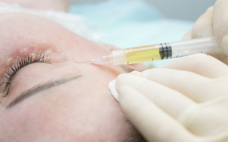 Plasma Therapy Novi | Skinfluence Aesthetics