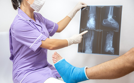 Innovations Transforming the Osteomyelitis Market: Treatment Landscape and Industry Analysis