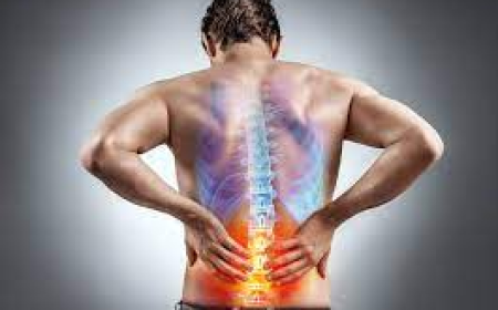 Get Back to Living Pain-Free with Nervisign 300
