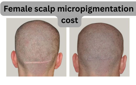 Female Scalp Micropigmentation: Cost Guide 2025