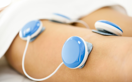 Electrical Stimulators Market Trends 2025: Innovations Driving Growth