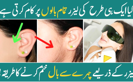 Can Laser Remove Thick Facial Hair? Yes—and Here’s How