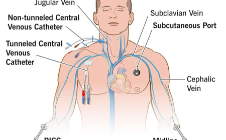 Parenteral Nutrition Market Focus on Sustainable and Waste-Reducing Packaging