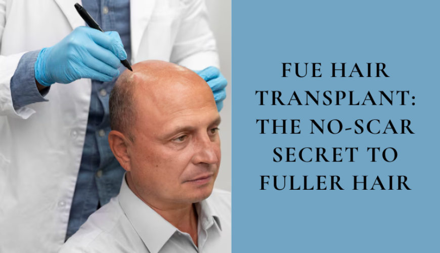 FUE Hair Transplant: The No-Scar Secret to Fuller Hair