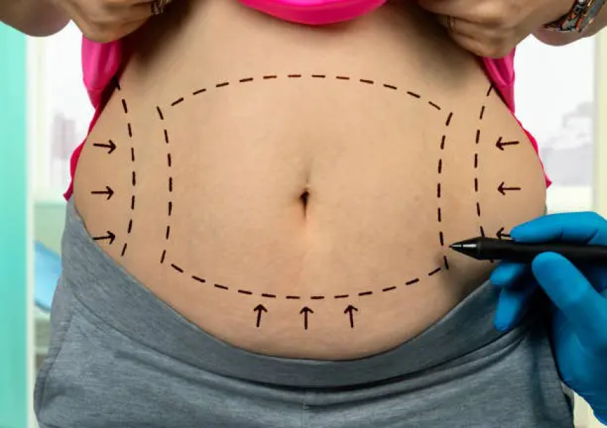 Mini Tummy Tuck Dubai vs. Full Tummy Tuck: What’s the Difference?
