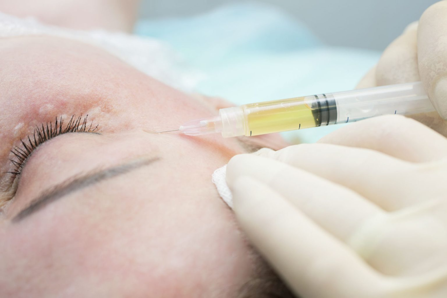 Plasma Therapy Novi | Skinfluence Aesthetics