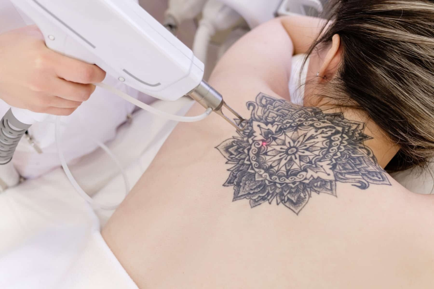 Erase the Past & Restore Your Skin: Advanced Laser Treatments Now Available in Lakewood Ranch, FL