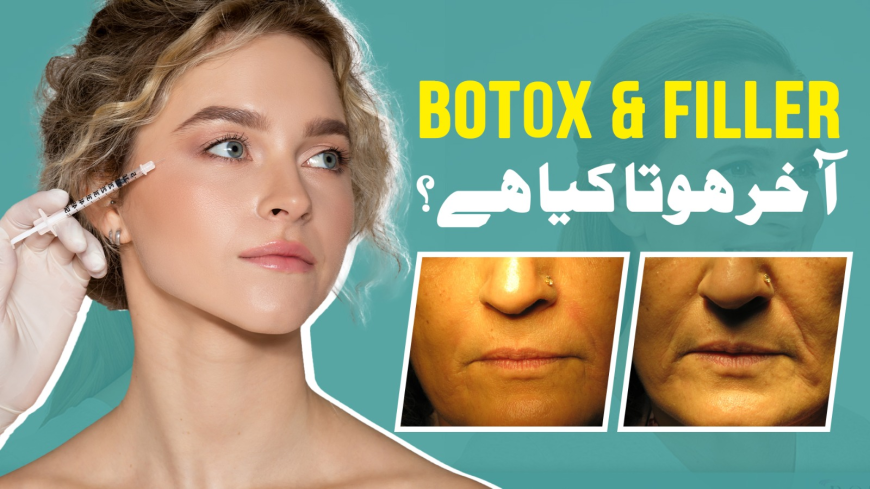 Safe Botox & Fillers in Pakistan