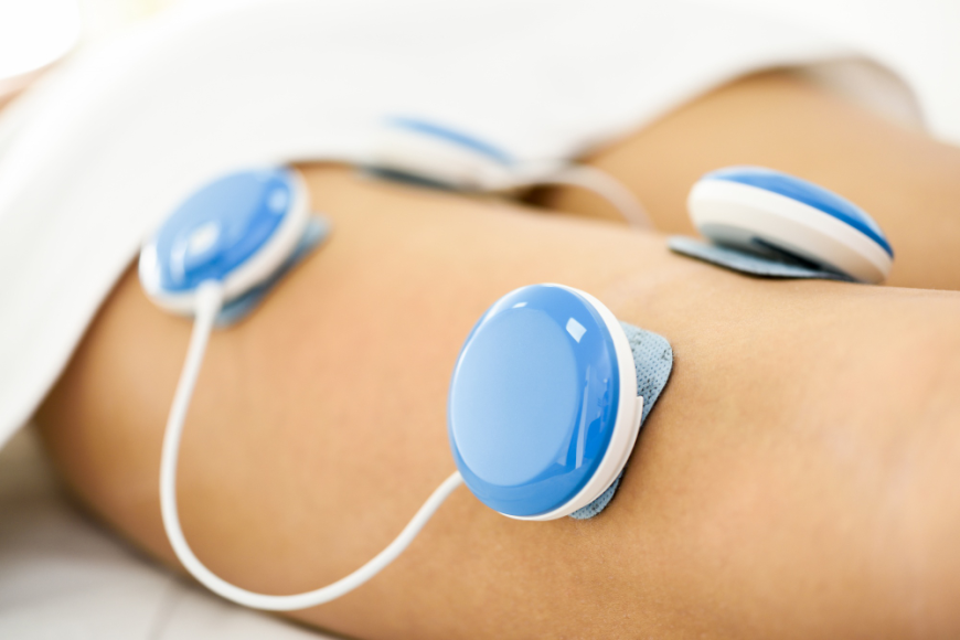 Electrical Stimulators Market Trends 2025: Innovations Driving Growth