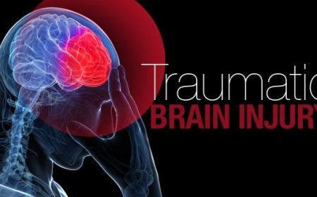 Unlocking the Brain: The Traumatic Brain Injury Diagnostics Equipment Market