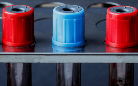 Residential Battery Storage Market: Size, Share, and Forecast 2025