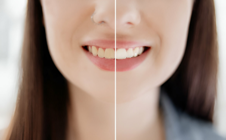 Considering Cosmetic Dentistry in Corsicana, TX? What You Need to Know