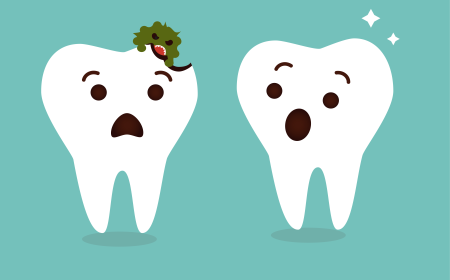 7 Surprising Causes of Cavities Without Sugar You Didn't Know About!
