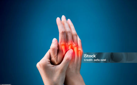 Rheumatoid Arthritis Market Trends 2025: Treatment Innovations and Market Growth