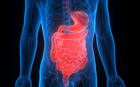 Malabsorption Syndrome Market Size, Analysis, and Growth Outlook 2025-2032