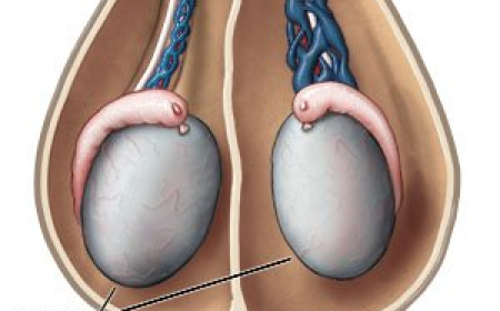Varicocele Treatments Explained: Options, Costs & Success Rates