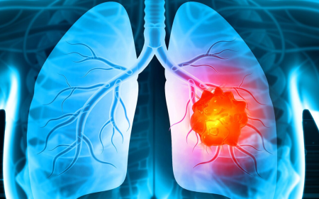 Cancer Pain Market Size, Trends, and Growth Strategies (2025-2032)