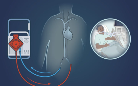 ATTR Amyloidosis Treatment Market Size, Trends, and Growth Strategies
