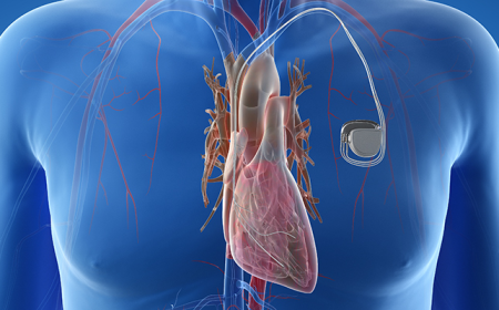 Global Cardiac Restoration Systems Market Growth and Strategic Insights