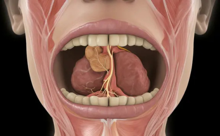 Salivary Gland Infection Market Size, Trends, and Growth Analysis 2025-2032