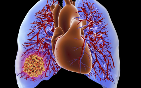 Chronic Thromboembolic Pulmonary Hypertension (CTEPH) Market Size, Growth, and Opportunities