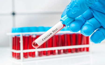 Calcium Test Price: Everything You Need to Know Before Booking