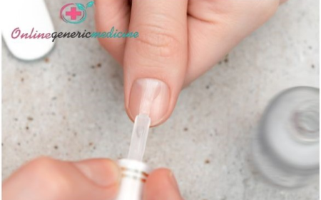 Comprehensive Guide to Fungal Nail Infection Diagnosis and Treatment