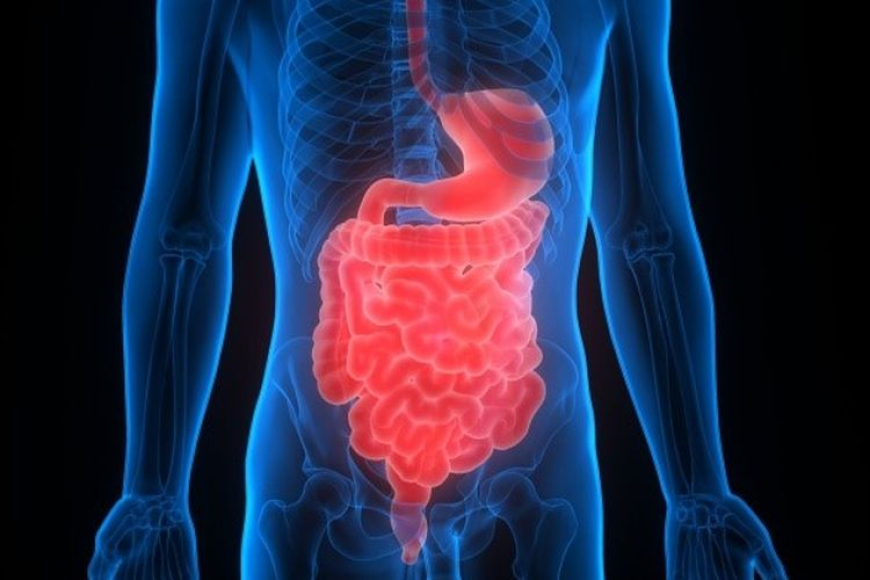 Malabsorption Syndrome Market Size, Analysis, and Growth Outlook 2025-2032