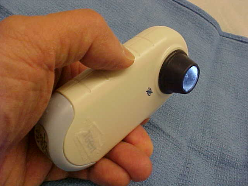 Dermatoscope Market Size, Trends, and Growth Strategies: A Comprehensive Analysis