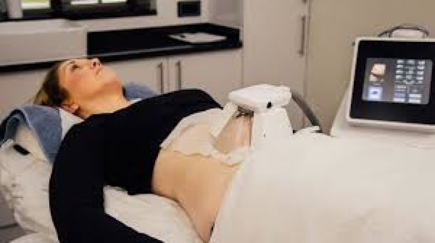 Top 5 Questions to Ask Before Getting Fat Removal Treatment Islamabad