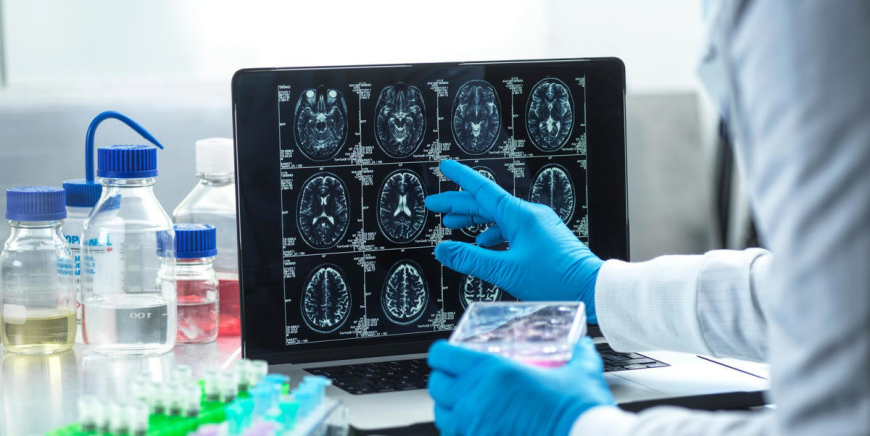 Medulloblastoma Drug Market Growth and Strategic Outlook 2025-2032