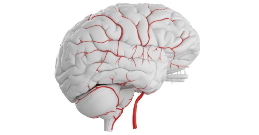 Vascular Dementia Market Size, Trends, and Growth Forecast 2025-2032