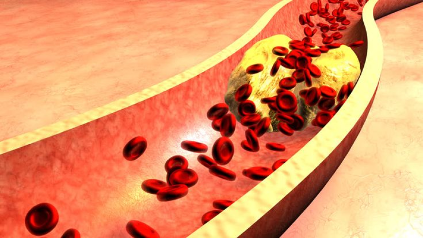Hypercholesterolemia Market Size, Trends, and Growth Outlook 2025-2032
