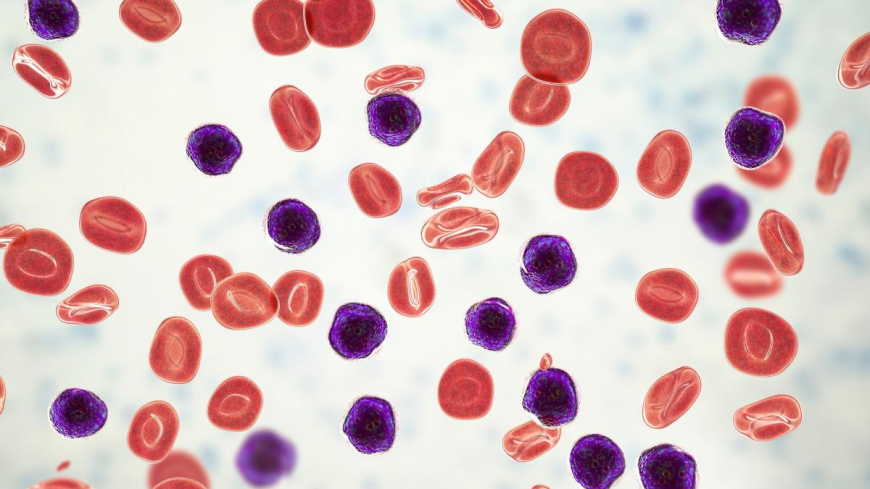 Chronic Myelomonocytic Leukemia Market Size, Trends, and Growth Outlook 2025-2032