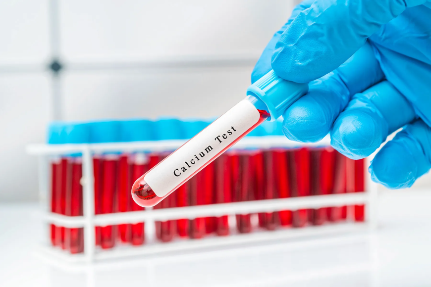 Calcium Test Price: Everything You Need to Know Before Booking