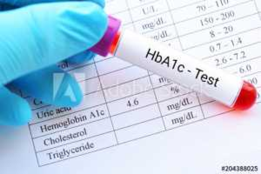Understanding HbA1c Test Price: What You Should Know Before Booking