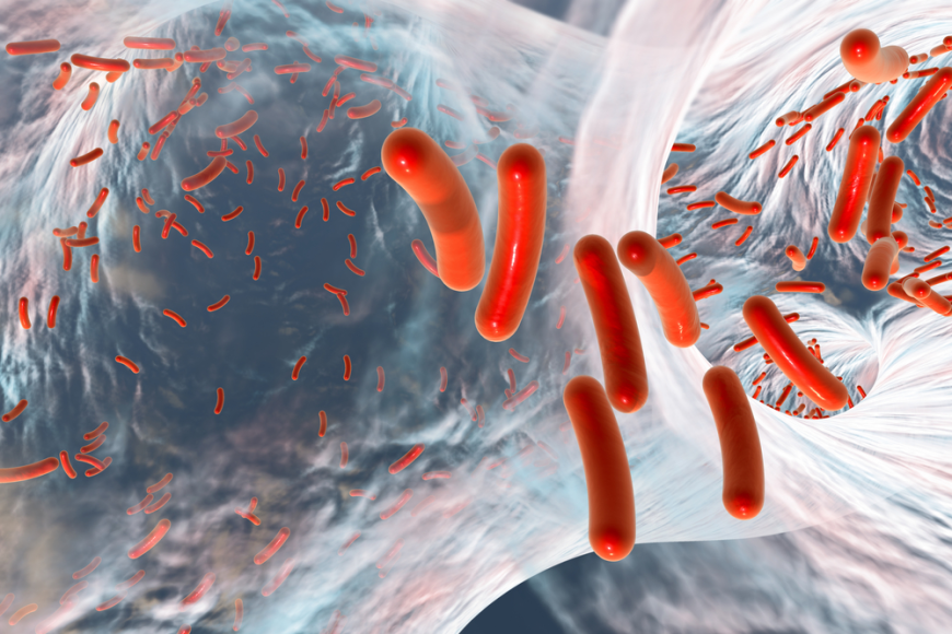 Pseudomonas Aeruginosa Infection Market Growth and Future Outlook 2025-2032