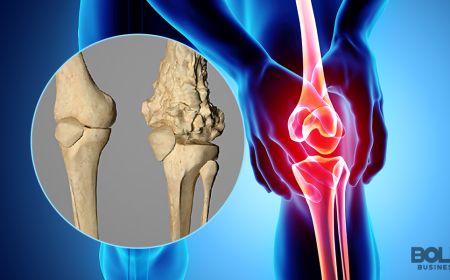 Osteosarcoma Treatment Market Size, Trends, and Growth Outlook 2025-2032