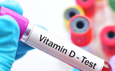 Vitamin D Test Price: Purpose, Procedure & Benefits