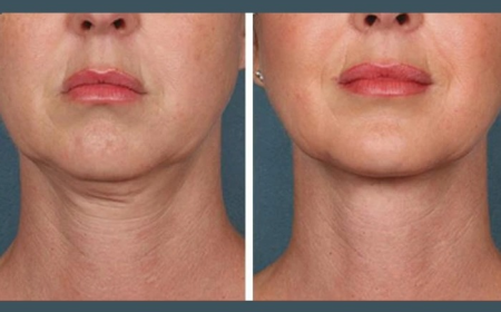 Best Aesthetic Clinic in Dubai for PRP Injection: Benefits for Facial Glow