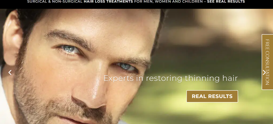 Male Pattern Baldness Cure in Yorkshire