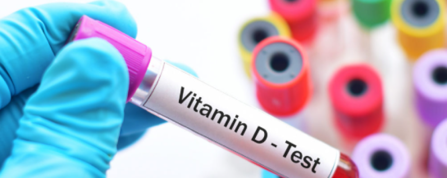 Vitamin D Test Price: Purpose, Procedure & Benefits