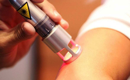 Transformative Benefits of Laser Therapy in Gurgaon