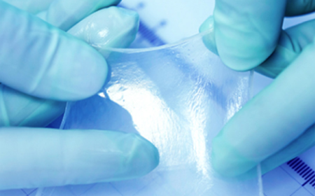 How Amniotic Membrane Grafts Revolutionize Wound Healing