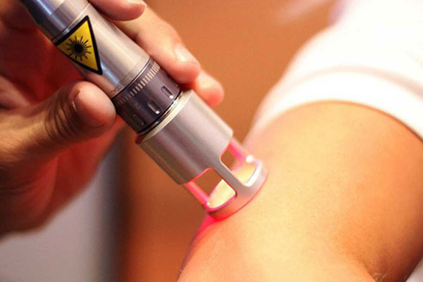 Transformative Benefits of Laser Therapy in Gurgaon